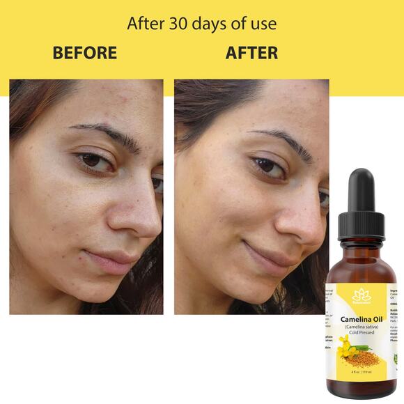 Vitamin E Oil – Ultra Moisture & Defense - Picture 11 of 11